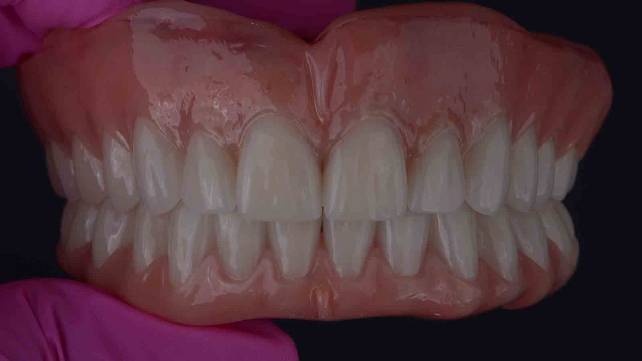 Delara: "Una Linea Di Denti Dalla Qualità Superiore - Foto 6