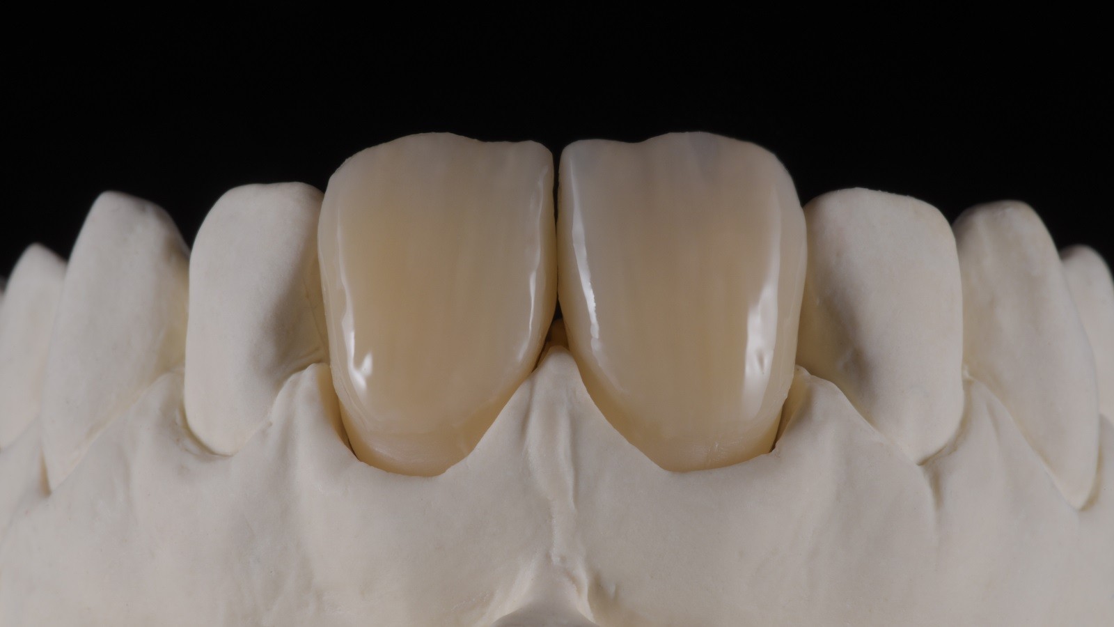 Concetto HeraCeram cre-active - take two