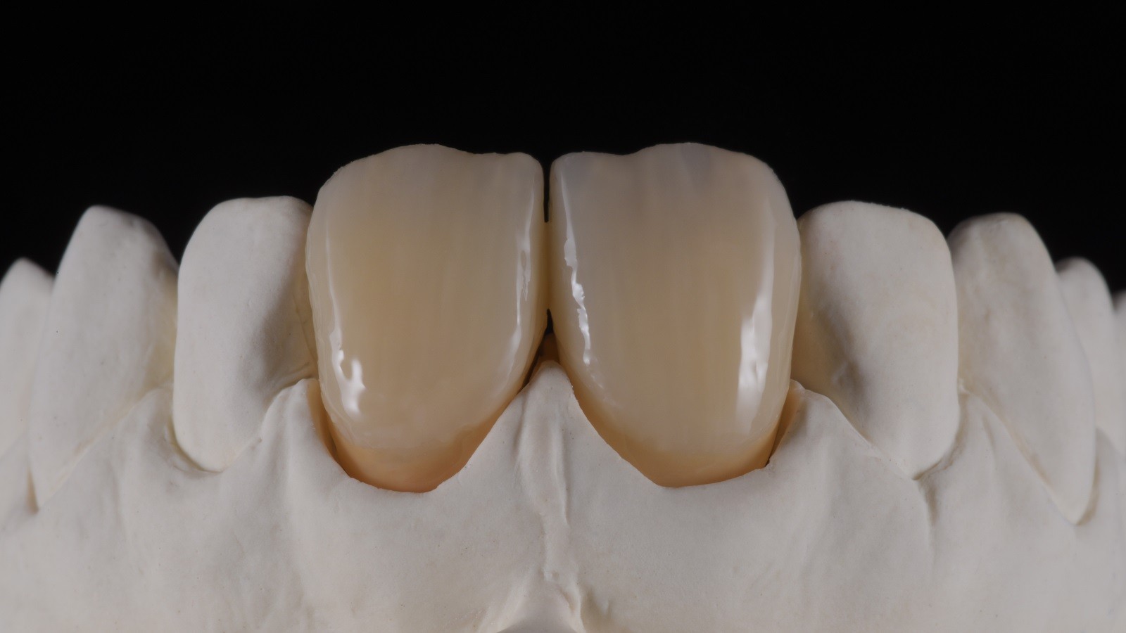 Concetto HeraCeram cre-active - take two