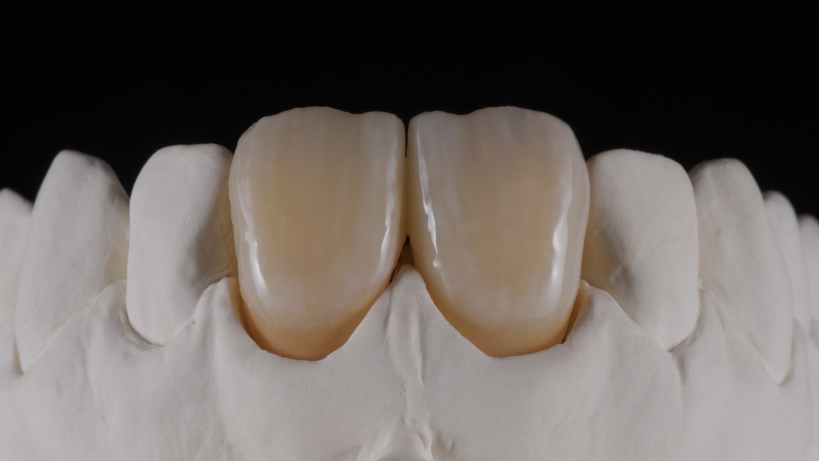 Concetto HeraCeram cre-active - take two