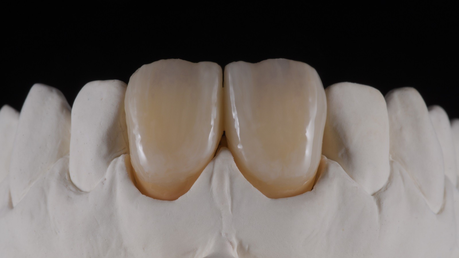 Concetto HeraCeram cre-active - take two