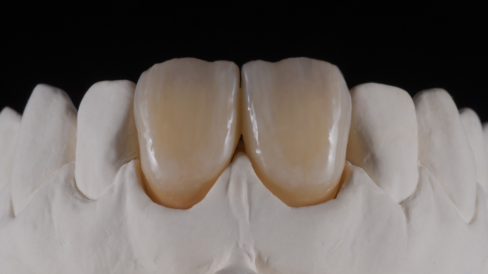 Concetto HeraCeram cre-active - take two