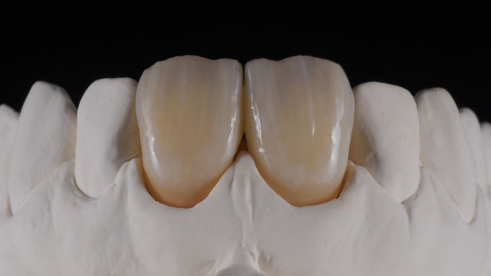 Concetto HeraCeram cre-active - take two