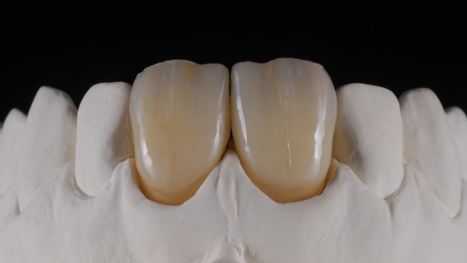 Concetto HeraCeram cre-active - take two