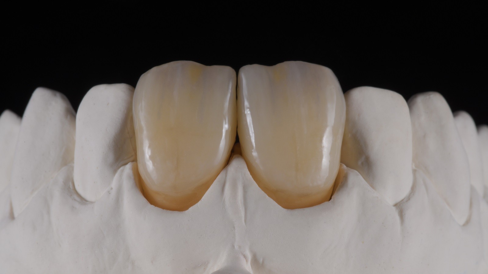 Concetto HeraCeram cre-active - take two