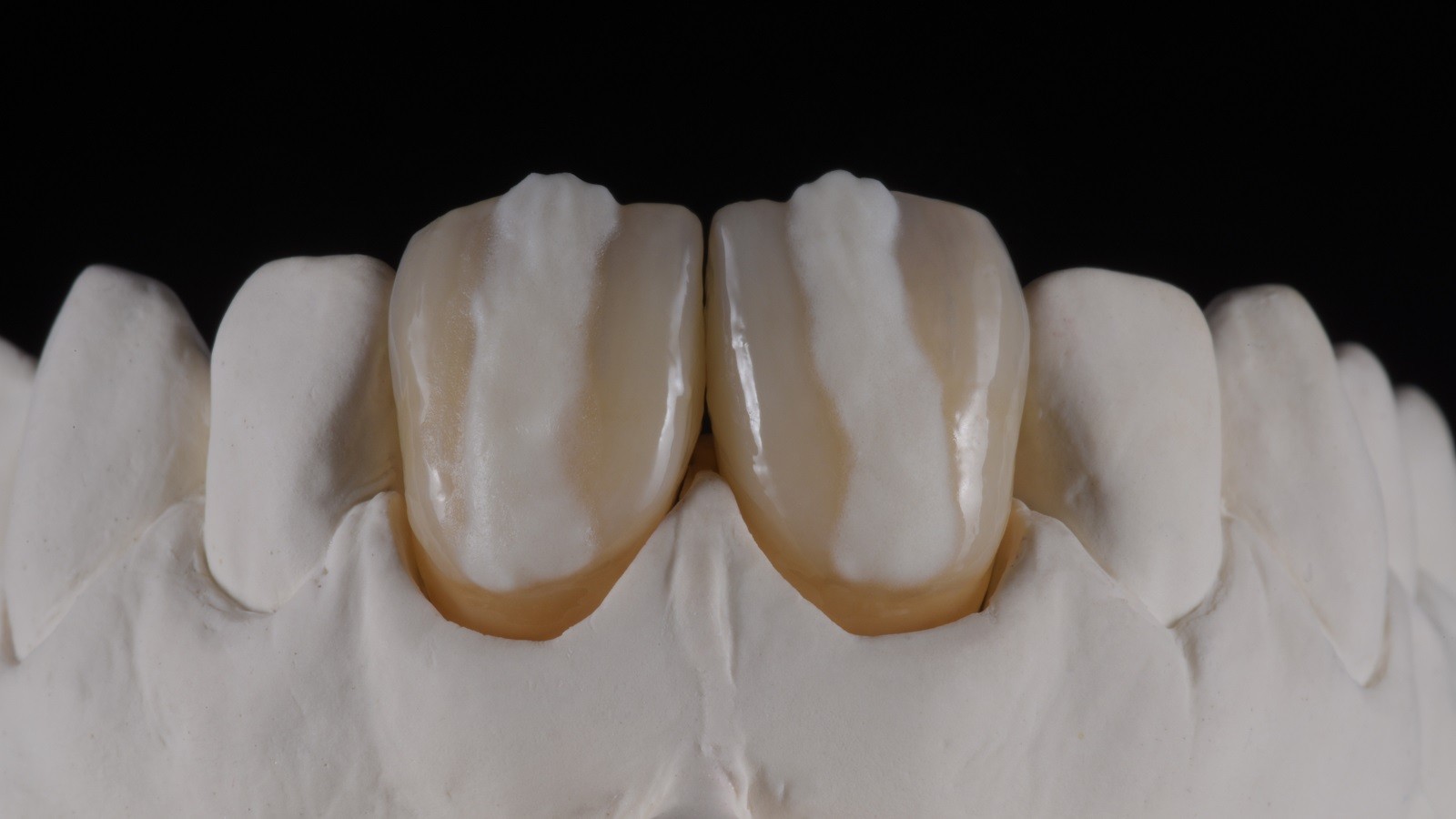 Concetto HeraCeram cre-active - take two