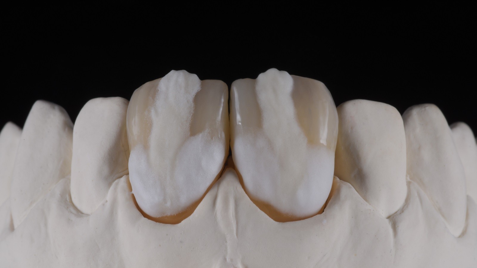 Concetto HeraCeram cre-active - take two