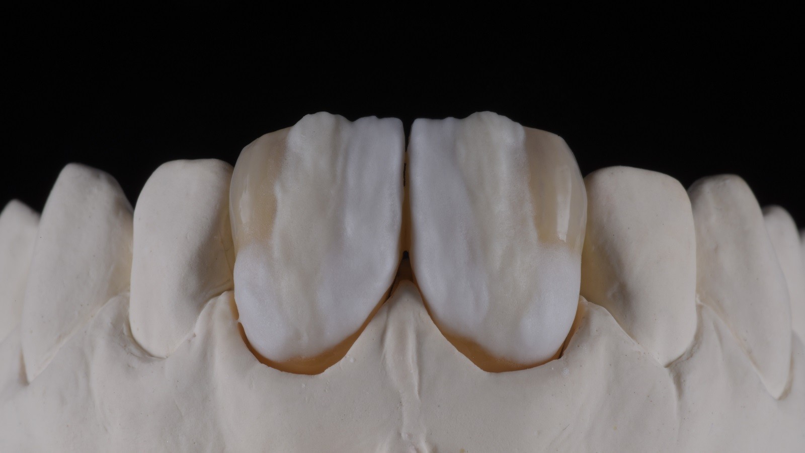 Concetto HeraCeram cre-active - take two