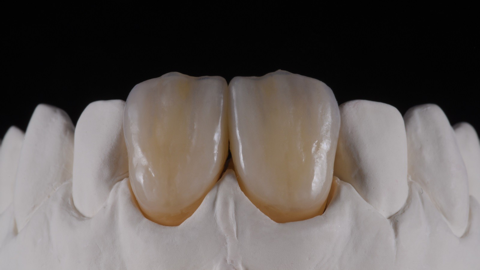 Concetto HeraCeram cre-active - take two