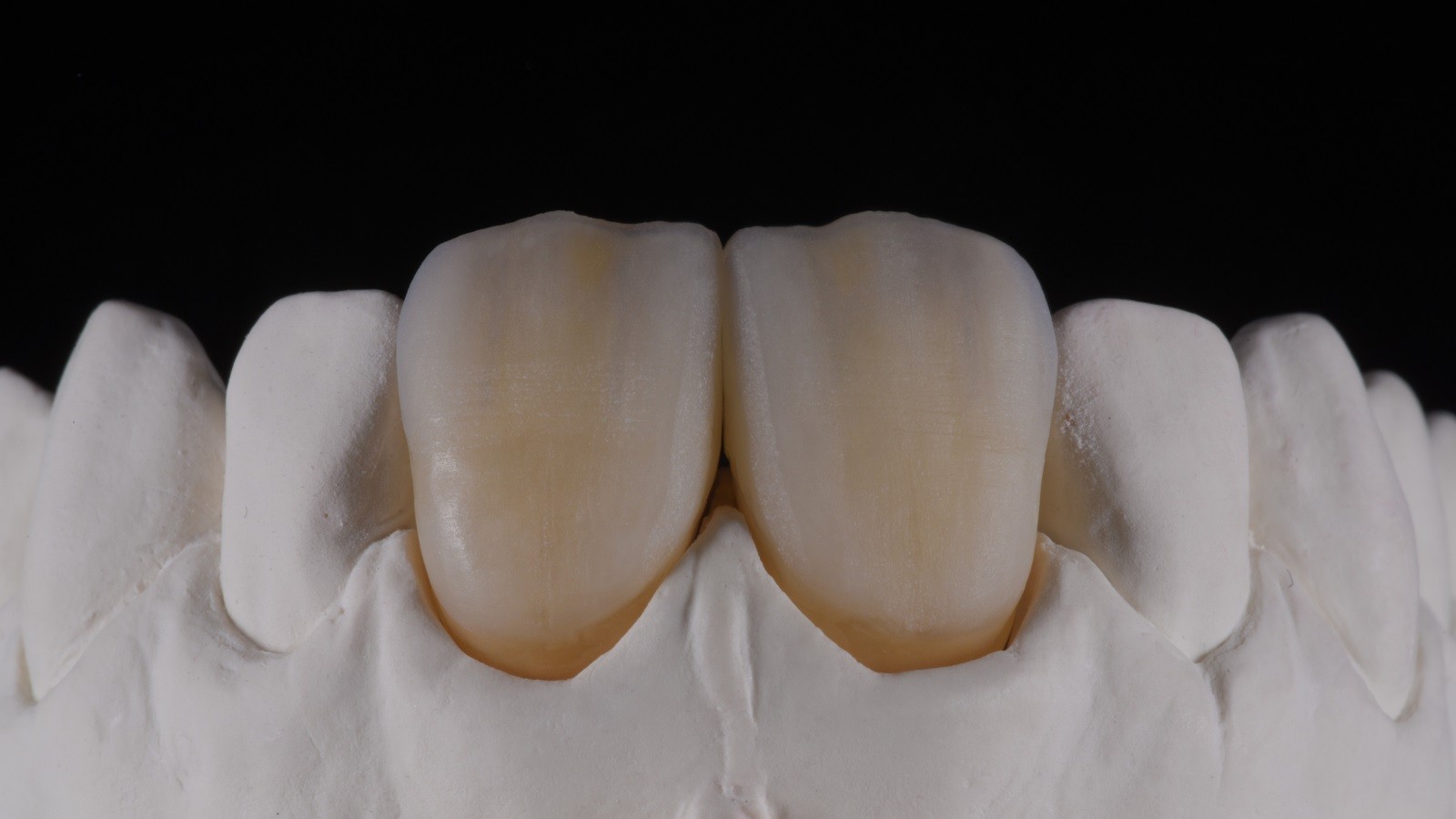 Concetto HeraCeram cre-active - take two