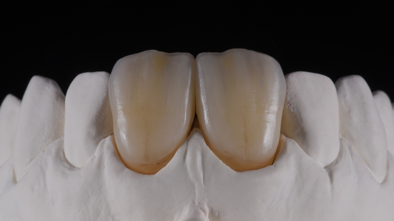 Concetto HeraCeram cre-active - take two