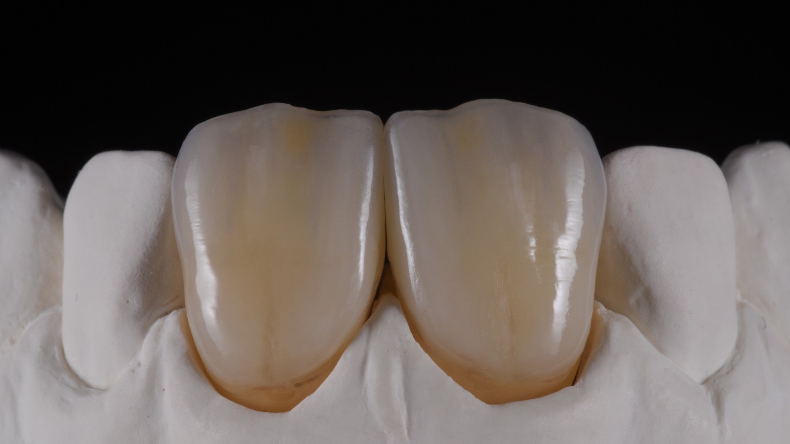 Concetto HeraCeram cre-active - take two